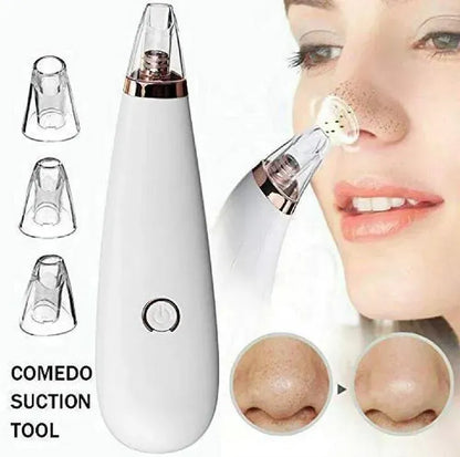 DermaSuction Professional Pore Cleaning Device – Vacuum Blackhead Remover with 4 Interchangeable Heads